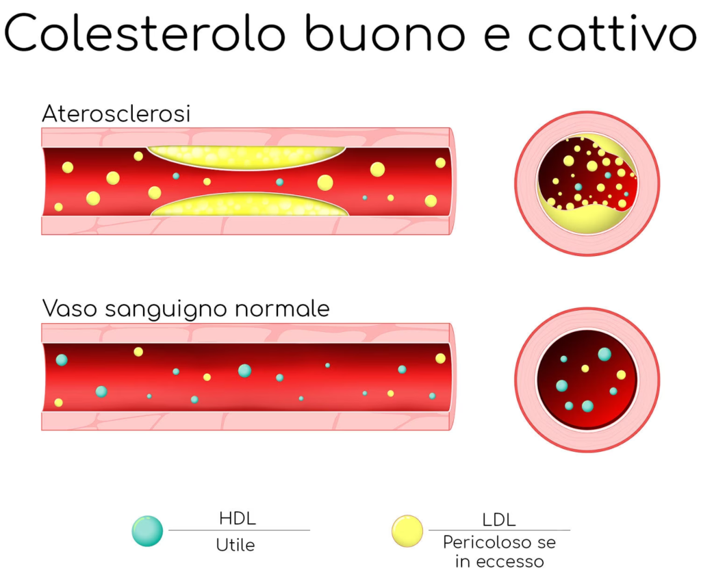 colesterolo